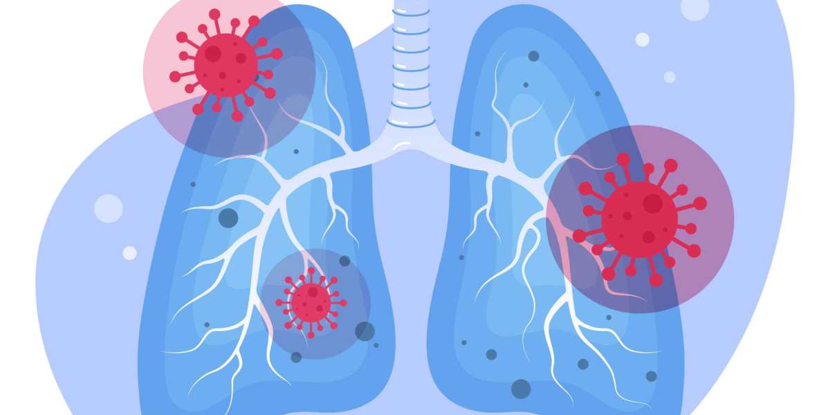 What Are the Best Ways to Prevent Pneumonia?
